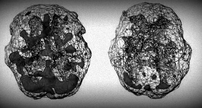 EMDR Intensives Newcastle